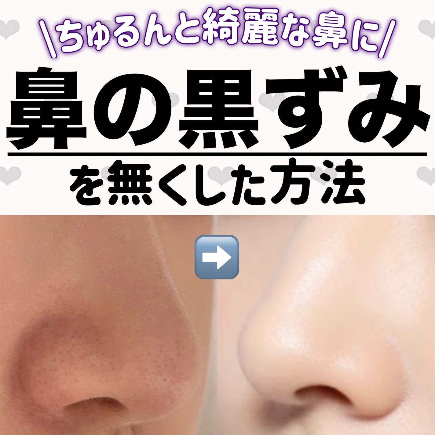 オバジC 酵素洗顔パウダー/オバジ/洗顔パウダーを使ったクチコミ(1枚目)