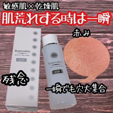 株式会社ピカイチ
リプロスキンローション
公式HP50ml(15日分)→3424円(込)定期購入あり

#ひかるんちゃんの化粧水
#ひかるんちゃんのアッププラスビューティー
#ひかるんちゃんのアッププラ