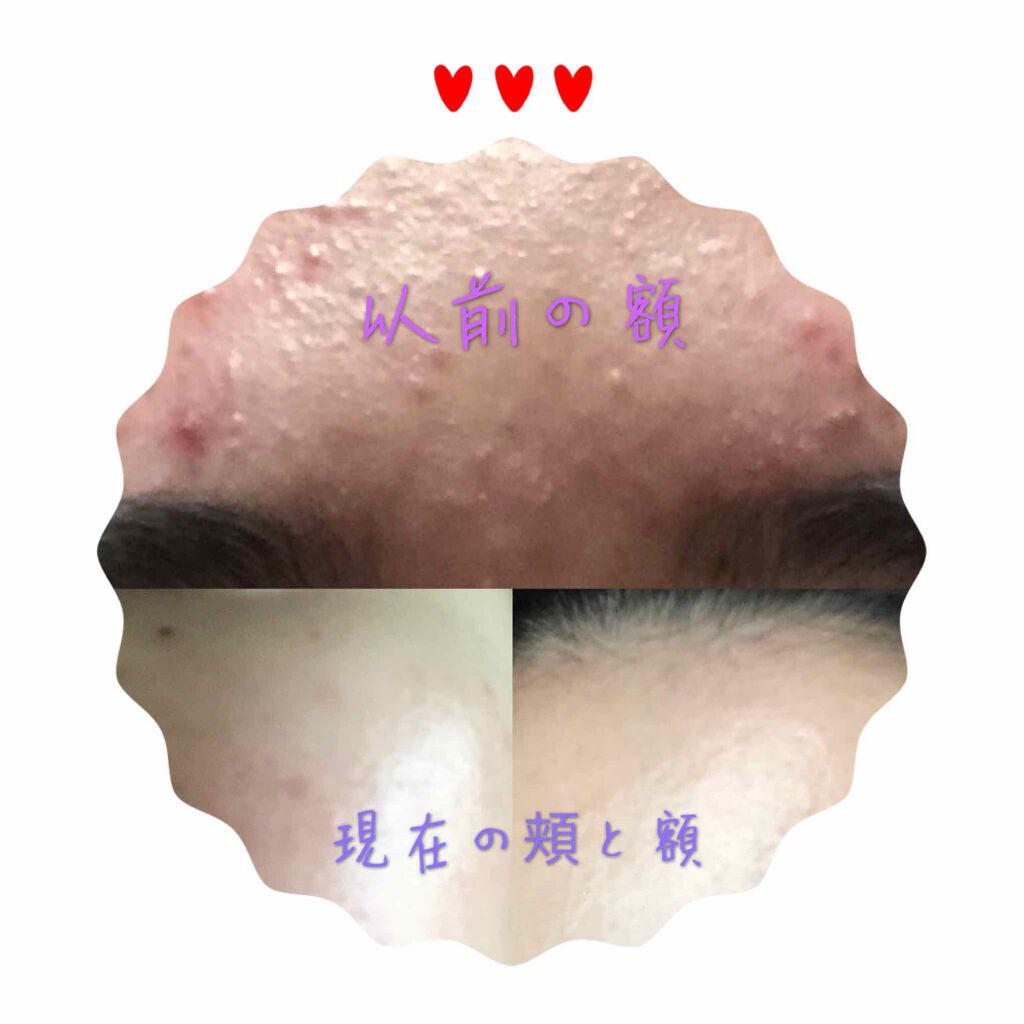 ドクタージャルト シカペアセラム /Dr.Jart+/美容液を使ったクチコミ(4枚目)