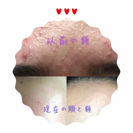 ドクタージャルト シカペアセラム /Dr.Jart+/美容液を使ったクチコミ(4枚目)