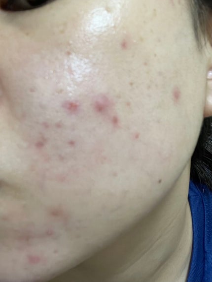 ã䜿ã£ãã¯ãã³ãïŒ3æç®ïŒ