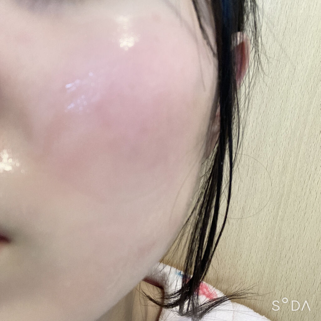 ももぷり フレッシュピールオフパック/ももぷり/ピーリングを使ったクチコミ（2枚目）