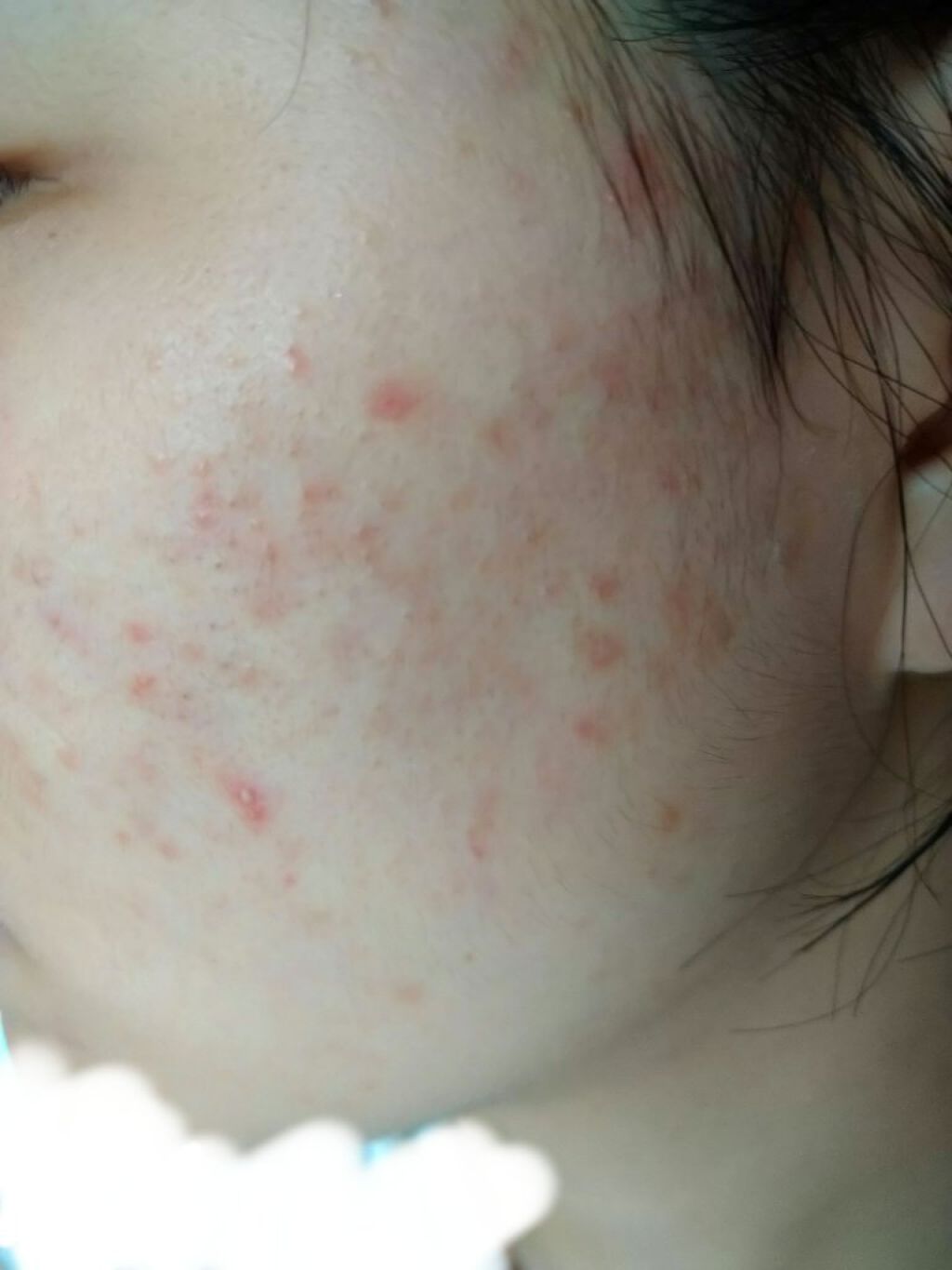 ハトムギ化粧水(ナチュリエ スキンコンディショナー R )/ナチュリエ/化粧水を使ったクチコミ（3枚目）