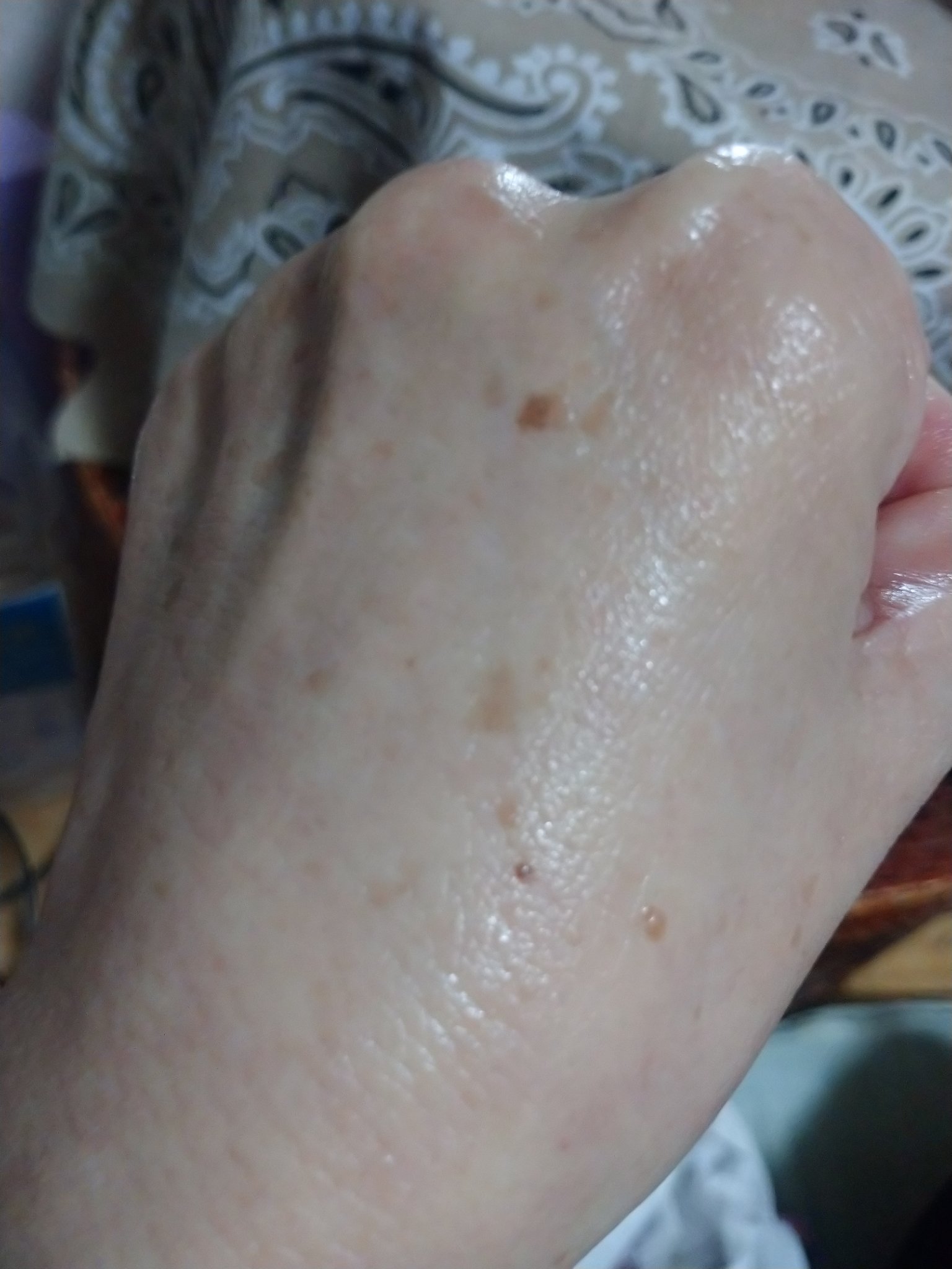 WINAGE PREMIUM ROSE VITAL AMPOULE/Coreana/美容液を使ったクチコミ（3枚目）