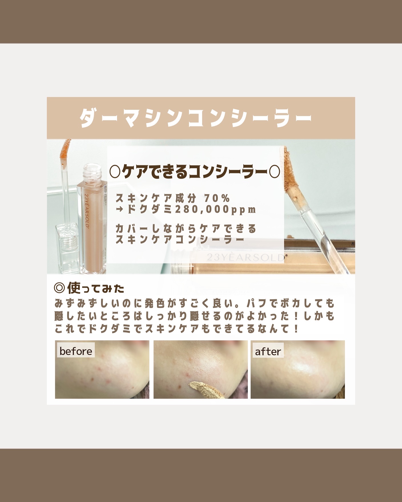 ダーマシンコンシーラー/23years old/リキッドコンシーラーを使ったクチコミ（2枚目）