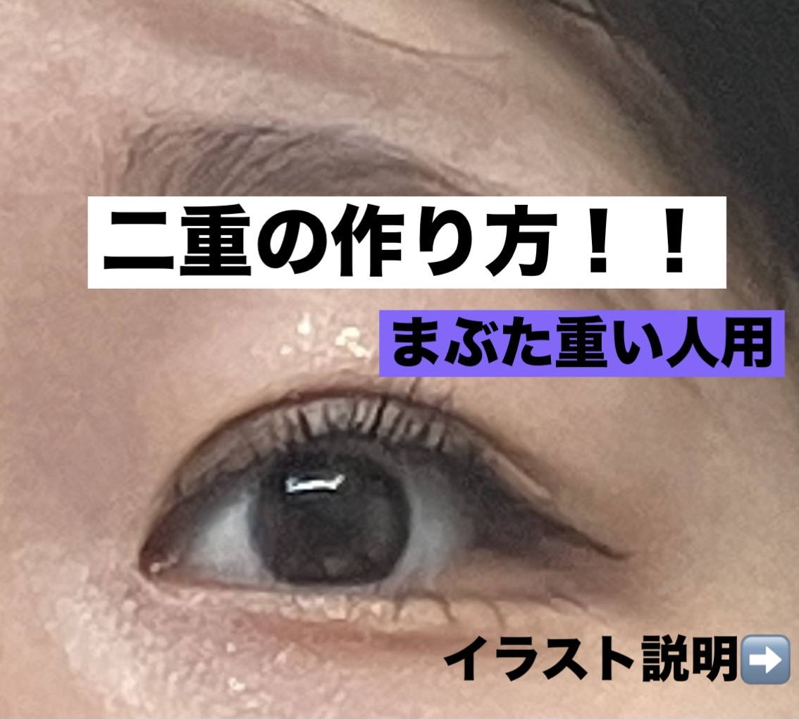 アイビューティー フィクサー WP/アストレア ヴィルゴ/二重まぶた用アイテムを使ったクチコミ（1枚目）