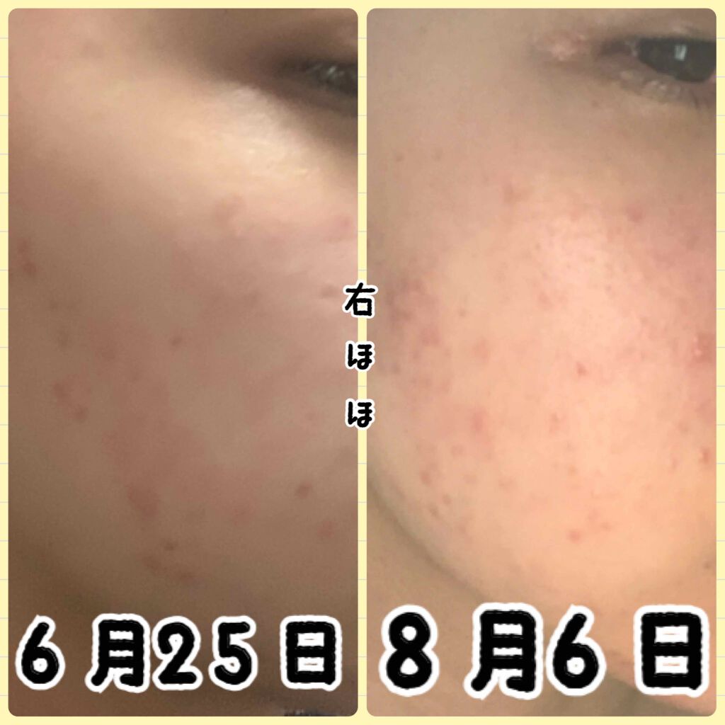 ニベアクリーム/ニベア/ボディクリームを使ったクチコミ(2枚目)