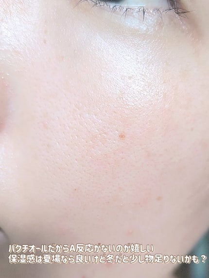 ビタミンA-mazingバクチオールナイトクリーム/By Wishtrend/フェイスクリームを使ったクチコミ(5枚目)