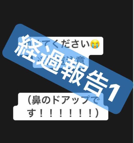 ジョンソンベビーオイル微香性/ジョンソンベビー/ボディオイルを使ったクチコミ(1枚目)