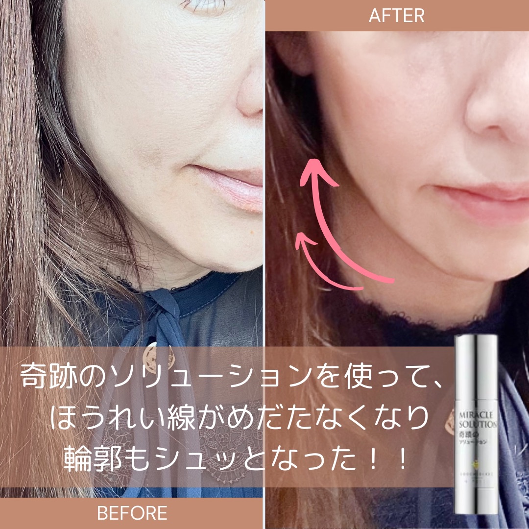 奇蹟のソリューション/YOUTHSECRET/美容液を使ったクチコミ（3枚目）
