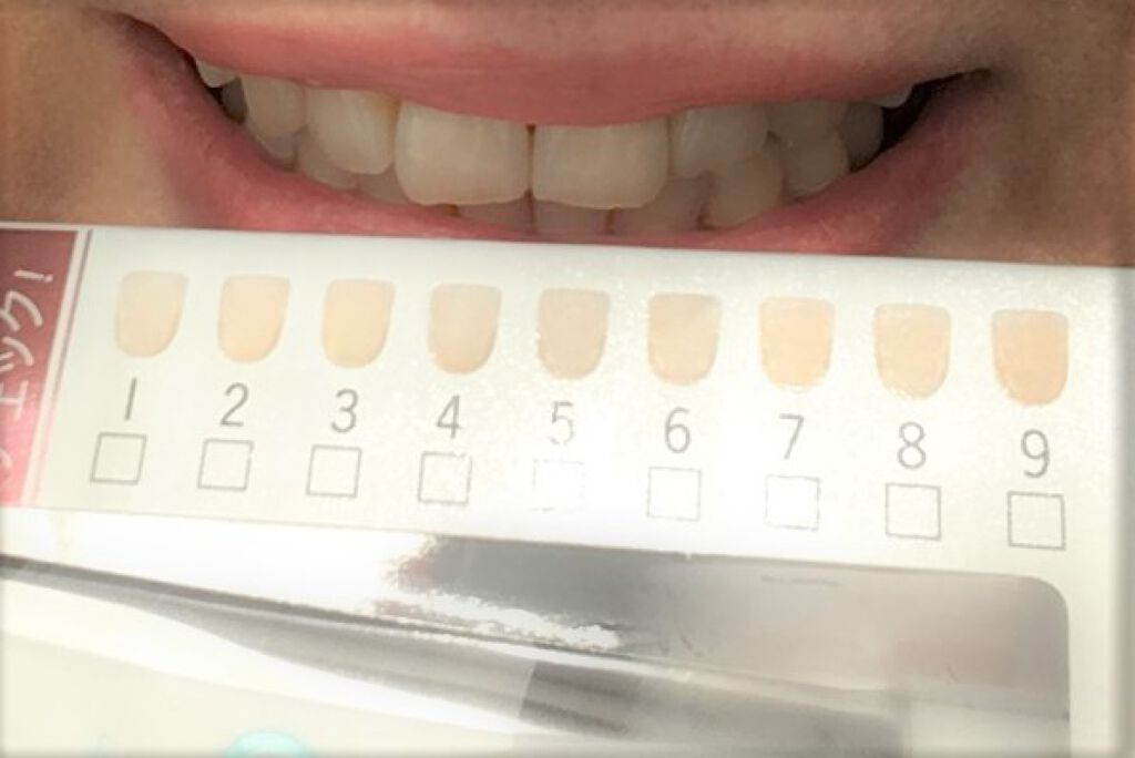 アパガードソフト/アパガード/歯磨き粉を使ったクチコミ(1枚目)