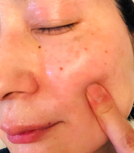 Cフォーカスマスク/CVITAS/シートマスク・パックを使ったクチコミ(4枚目)