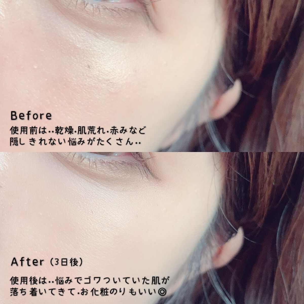 パーフェクト アンプル セラム イドラ/9Wishes/美容液を使ったクチコミ（3枚目）