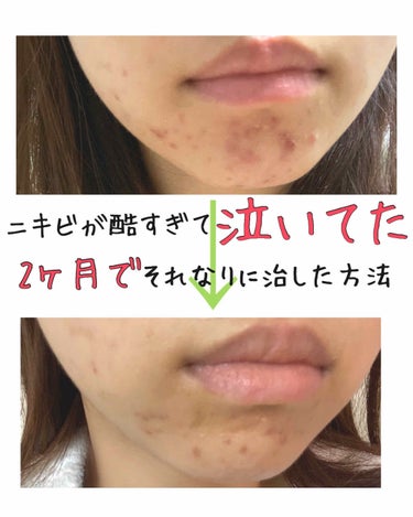 敏感肌用薬用美白美容液/無印良品/美容液を使ったクチコミ（1枚目）