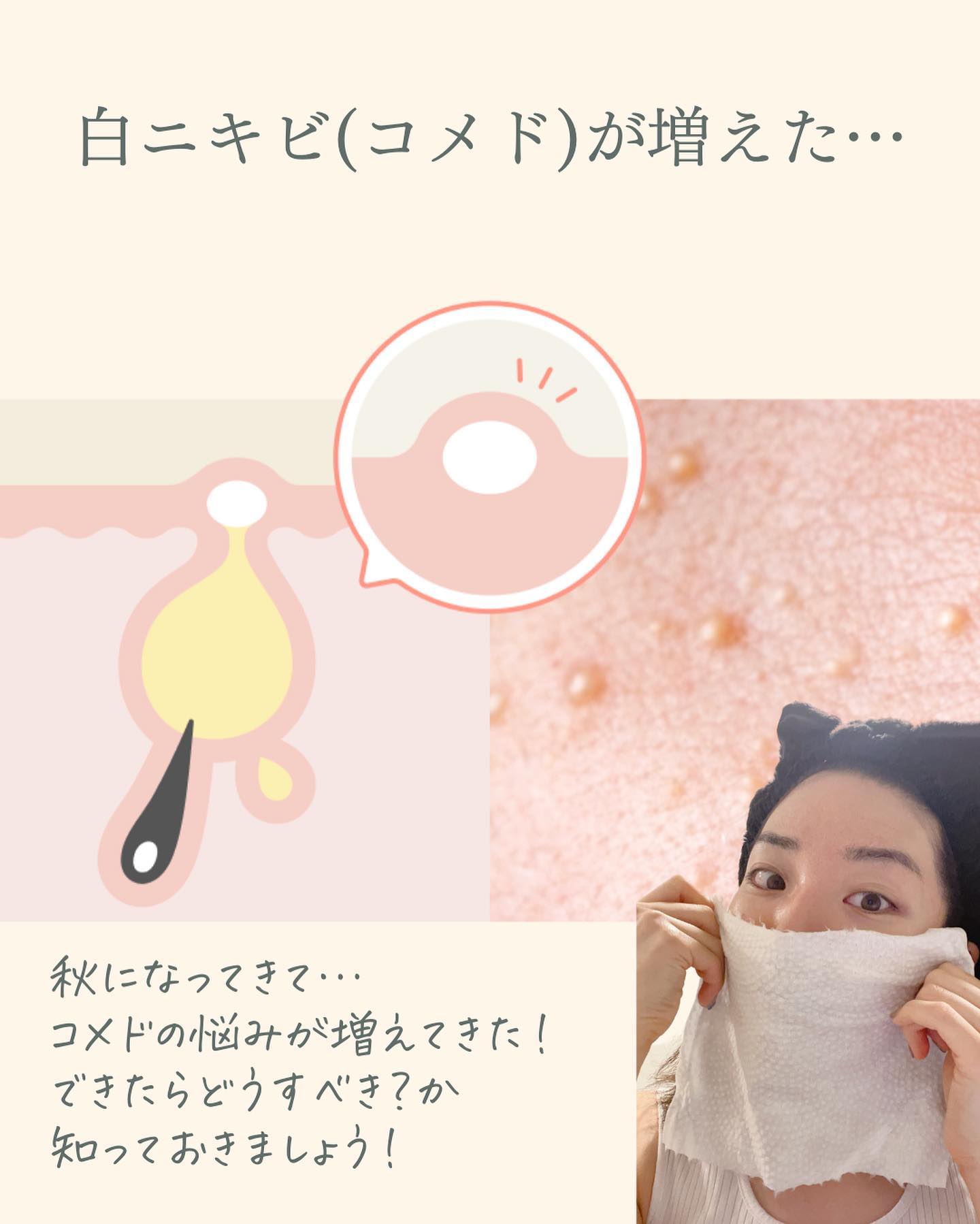 ルミスパ スターター キット/ニュースキン/美顔器・マッサージを使ったクチコミ（2枚目）