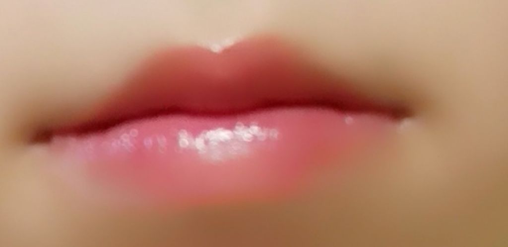 モアリップ N (医薬品)/資生堂薬品/その他を使ったクチコミ（1枚目）