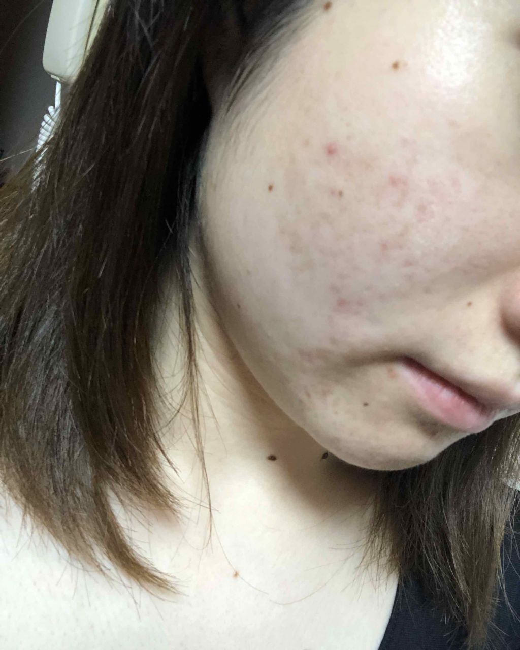 マンスリースキンケアプログラム(旧)/APEX/スキンケアキットを使ったクチコミ(3枚目)