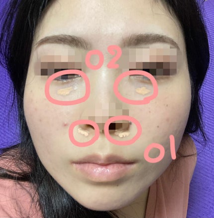 デザイニング コンシーラー/ブリリアージュ/リキッドコンシーラーを使ったクチコミ(4枚目)