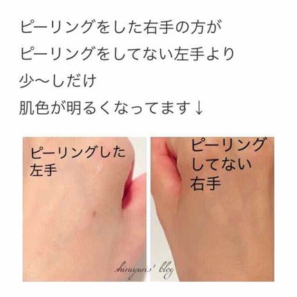 フェイスピーリングジェル ピーチの香り/DAISO/ピーリングを使ったクチコミ(4枚目)