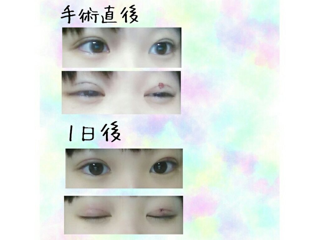 ð» ïŸïŸïŸâïŸ
ïŸ ð© on LIPS ãâäºéæŽåœ¢ãåæ²¡æ³ãâ ãé²èŠ§æ³šæãç®å
ã®ç»åãããŸãããã«ã¡ã¯..ãïŒ2æç®ïŒ