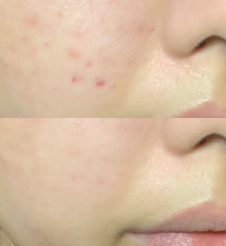 EGFアランテノールクリーム/CELLINSHOT/フェイスクリームを使ったクチコミ（1枚目）