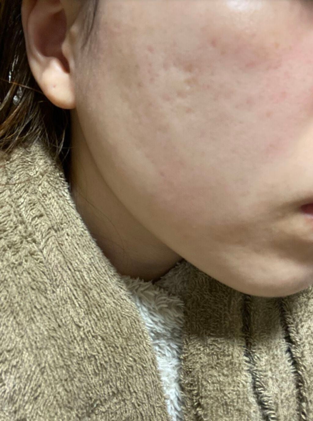 ティーツリーウォーター/ラッシュ/ミスト状化粧水を使ったクチコミ(1枚目)