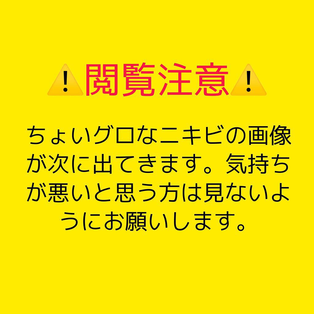 ミノン アミノモイスト モイストチャージ ローションI しっとりタイプ/ミノン/化粧水を使ったクチコミ(1枚目)