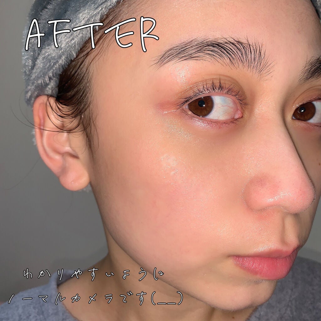 N.M.FアクアアンプルマスクJEX/MEDIHEAL/シートマスク・パックを使ったクチコミ(4枚目)