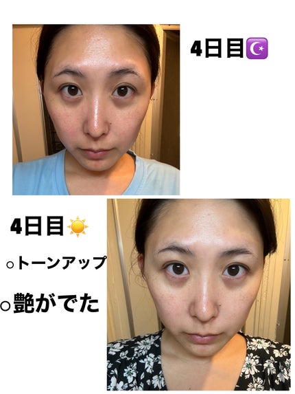 S100 レチAリードル/VT/美容液を使ったクチコミ(3枚目)