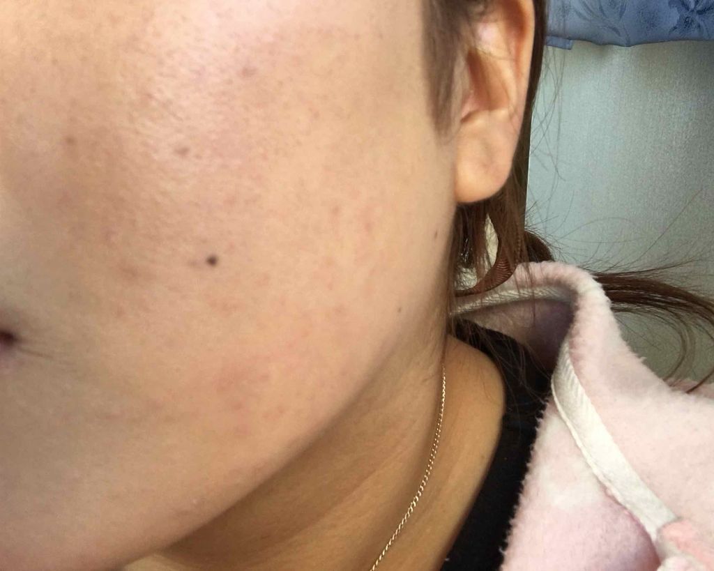 エスポルール メイクアップベース/エスポルール/化粧下地を使ったクチコミ(3枚目)