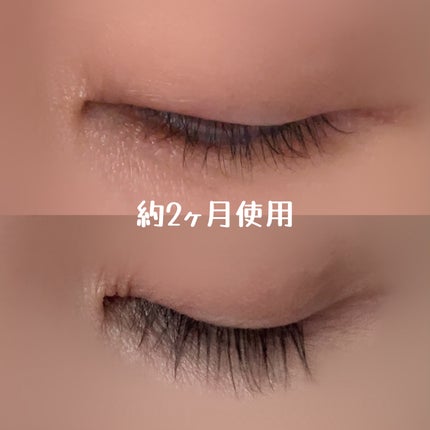 ラッシュアディクト アイラッシュコンディショニングセラム/soaddicted/まつげ美容液を使ったクチコミ(4枚目)