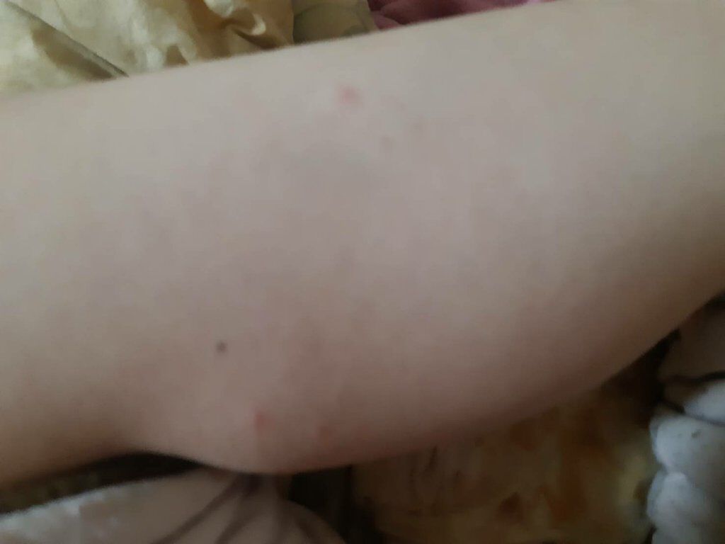 ジョンソン ベビーオイル 無香料/ジョンソンベビー/ボディオイルを使ったクチコミ(2枚目)