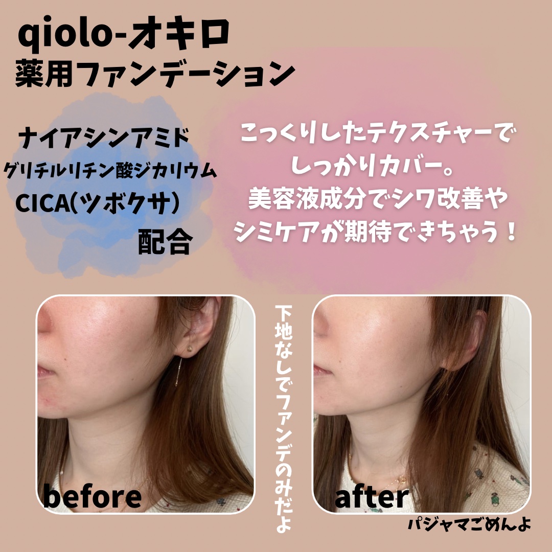 スキンセラムファンデーション/qiolo/リキッドファンデーションを使ったクチコミ（2枚目）