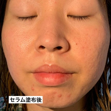 ザ セラム ブライトニング/アスタリフト/美容液を使ったクチコミ(8枚目)