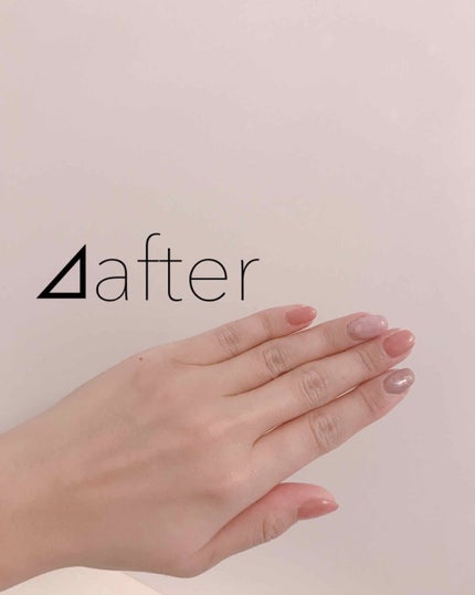 薬用ホワイトコンク ホワイトニングCC CII/ホワイトコンク/ボディクリームを使ったクチコミ(3枚目)