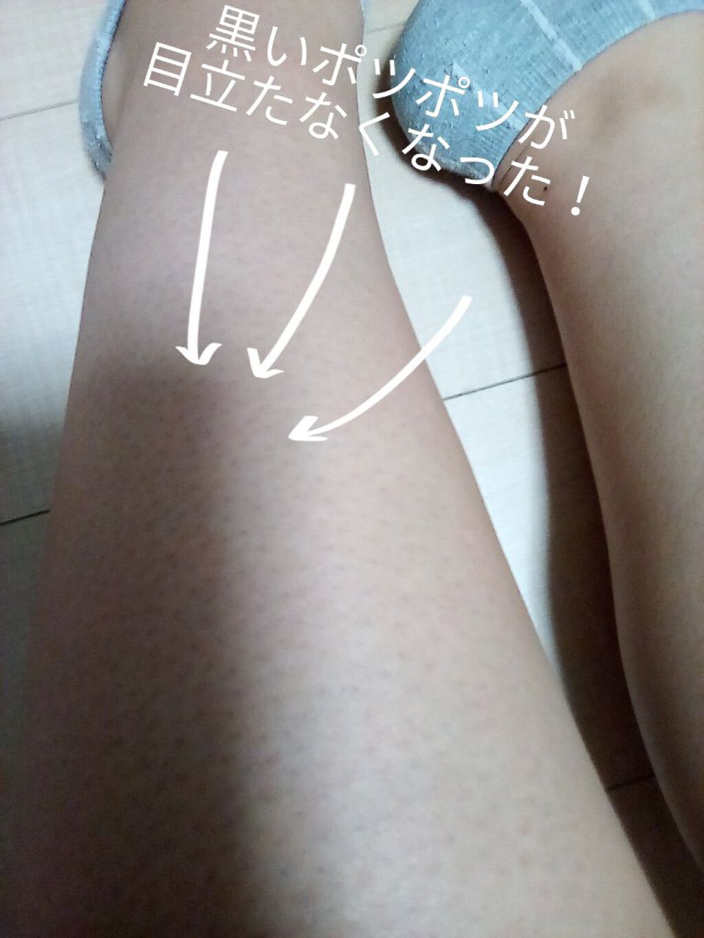 ニベアクリーム/ニベア/ボディクリームを使ったクチコミ(6枚目)