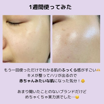 アットクリニック ボルフィリン リンクルショット アンプル/DOMINAS/美容液を使ったクチコミ(4枚目)