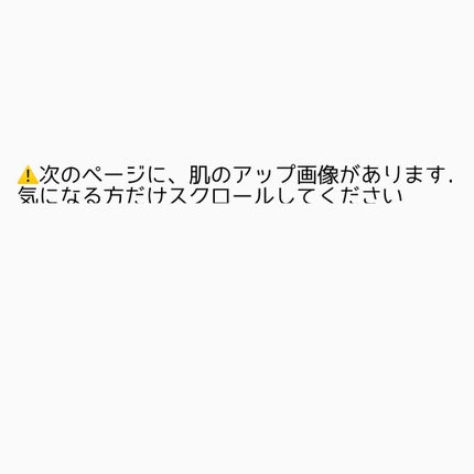 ミノン アミノモイスト 薬用アクネケア ローション/ミノン/化粧水を使ったクチコミ(2枚目)