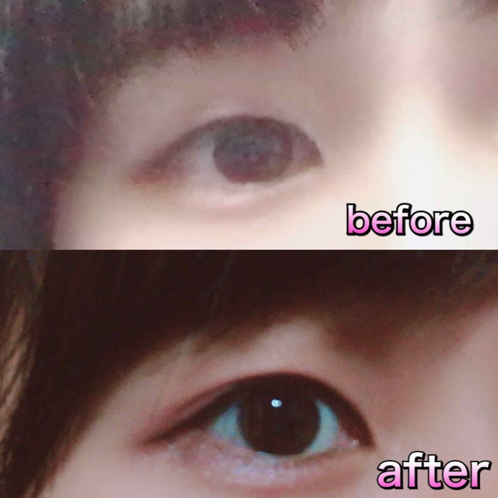 アイトーク/アイトーク/二重まぶた用アイテムを使ったクチコミ(2枚目)