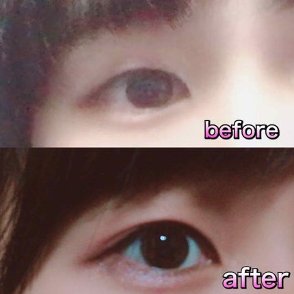 アイトーク/アイトーク/二重まぶた用アイテムを使ったクチコミ(2枚目)