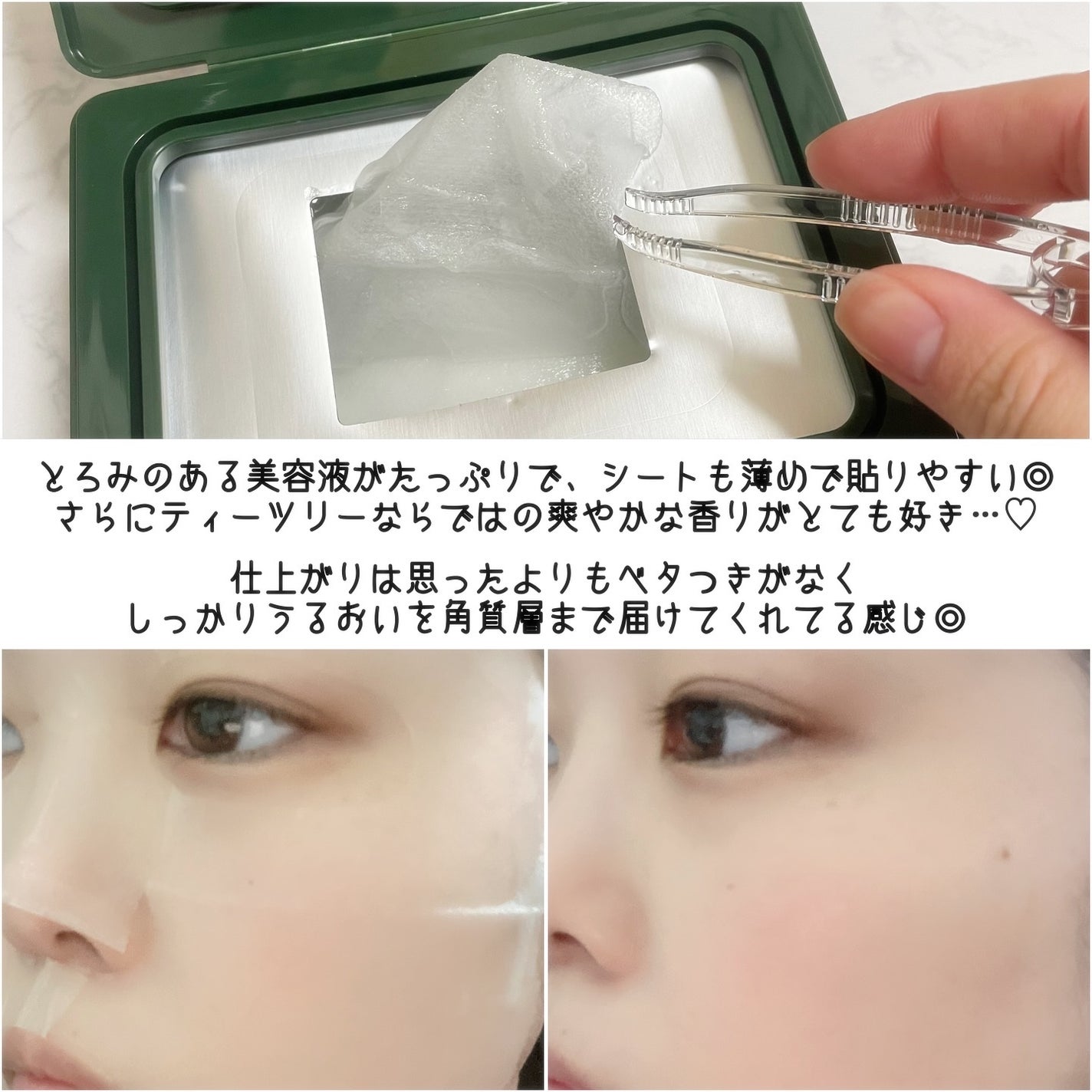 THE N.M.F 365 アクアマスク/MEDIHEAL/シートマスク・パックを使ったクチコミ(6枚目)