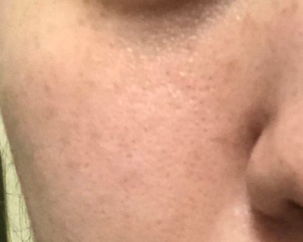 かや on LIPS 「助けて下さい(スキンケア)⚠️写真閲覧⚠️助けて下さい…🙇♂..」(5枚目)