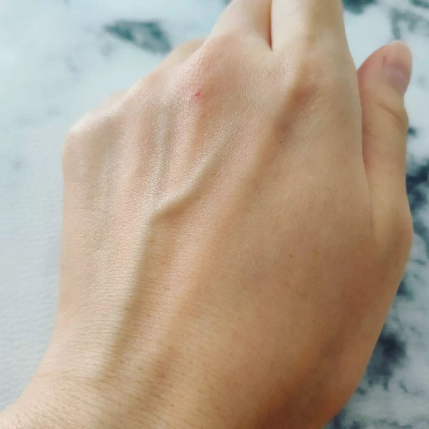 VCE セラム/ダーマセプトRX/美容液を使ったクチコミ(4枚目)