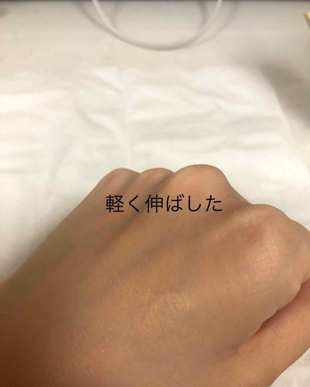 薬用コンシーラー アクネプロテクター/ONLY MINERALS/パウダーコンシーラーを使ったクチコミ(4枚目)