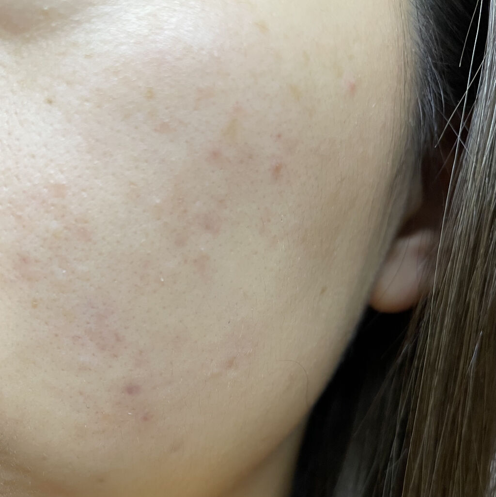 化粧水・敏感肌用・高保湿タイプ/無印良品/化粧水を使ったクチコミ（1枚目）