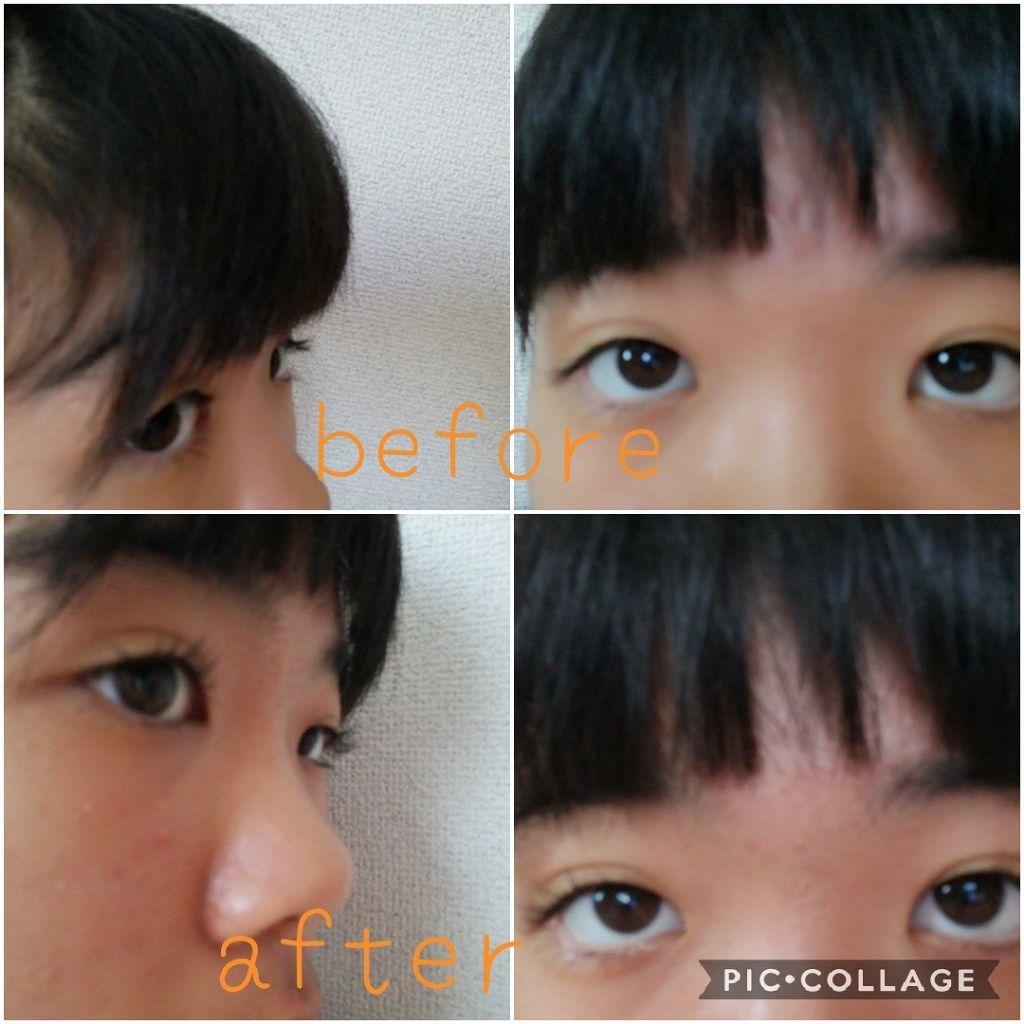 ディープビューラー/セリア/ビューラーを使ったクチコミ(1枚目)