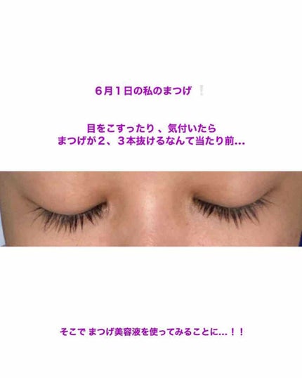 スカルプD ボーテ ピュアフリーアイラッシュセラム/アンファー(スカルプD)/まつげ美容液を使ったクチコミ(3枚目)