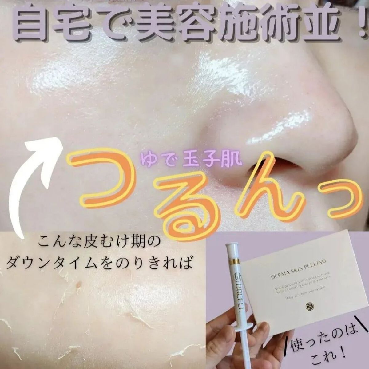 を使ったクチコミ（1枚目）