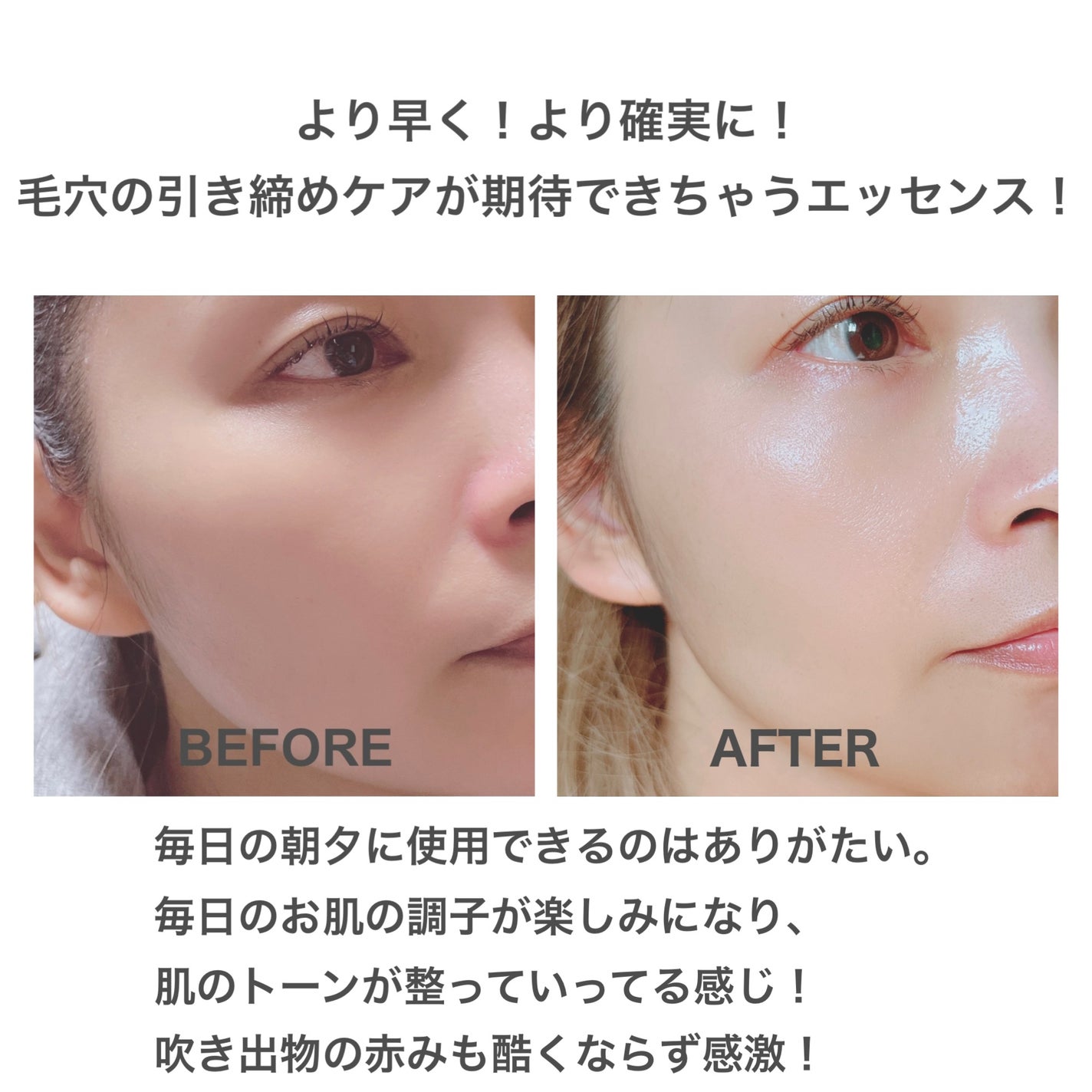 シカレチA エッセンス0.1/VT/美容液を使ったクチコミ(5枚目)