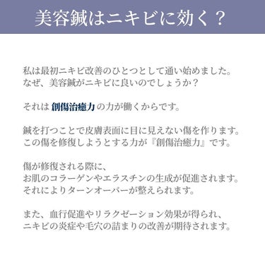 あや | 美容オタク🌷30代会社員 on LIPS 「私のおすすめ施術🫶🏻🤍『美容鍼』私は2~3週間に1度、施術して..」（3枚目）